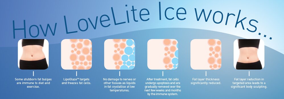 If you smile we smile   teeth whitening from LoveLite White